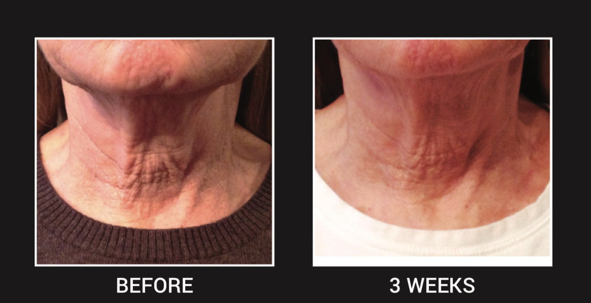 Age Defying Neck Cream