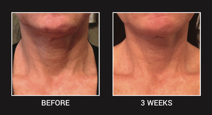 Age Defying Neck Cream